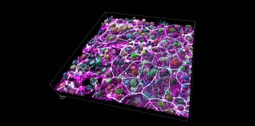 Monocapes d'organoides nasals de porc infectades amb bacteris fluorescents.